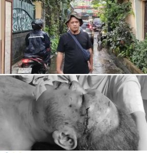 Wartawan di Medan Ditemukan MD dengan Luka Diduga Akibat Pengani4y44n ‎